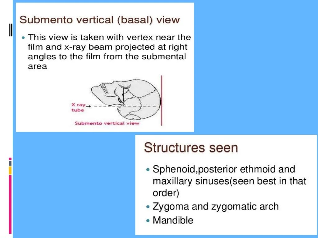 Spotting techniques slideserve ppt powerpoint presentation